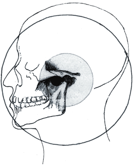 CMD = Cranio mandibuläre Dysfunktion.